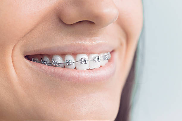 Best Dental Inlays and Onlays  in South Patrick Shores, FL
